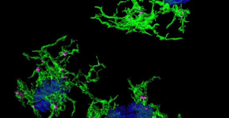 Обнаружена сигнатура гена микроглии, поедающей бляшки при болезни Альцгеймера