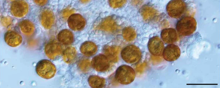 Спустя 140 лет биологи «воскресили» род странных желтых клеток
