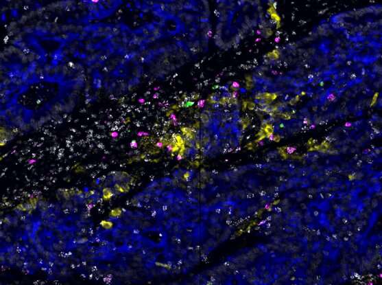 Хабы иммунных клеток прячутся в опухолях