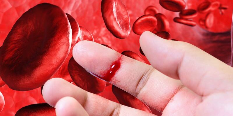 Новая генная терапия может снизить риск кровотечения у пациентов с гемофилией