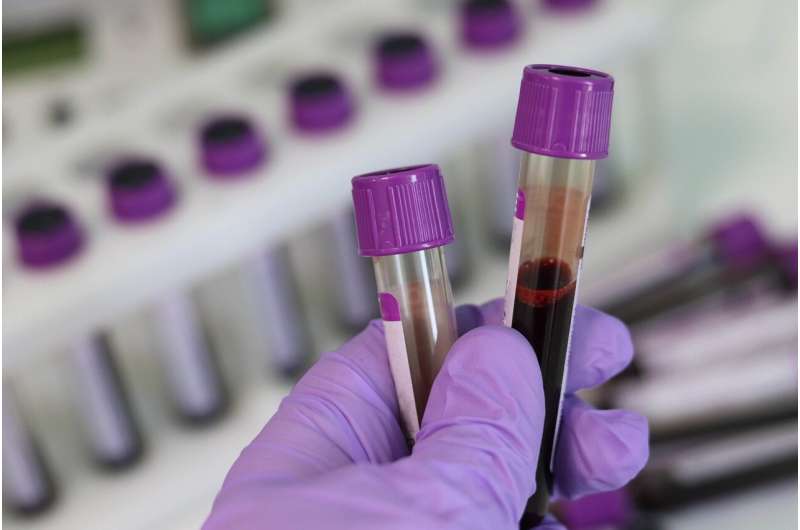 Всего с помощью столовой ложки крови исследователи стремятся изменить лечение рака