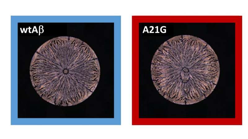 Пептидный «отпечаток пальца» позволяет более раннюю диагностику болезни Альцгеймера